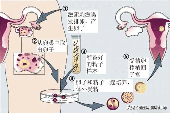 美国试管排名_美国试管婴儿技术最先进的_美国试管婴儿排名