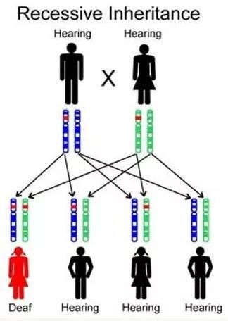 人工耳蜗哪个较好咨询0爱耳时代_人工耳蜗医院0爱耳时代官网_人工耳蜗救助0爱耳时代官网