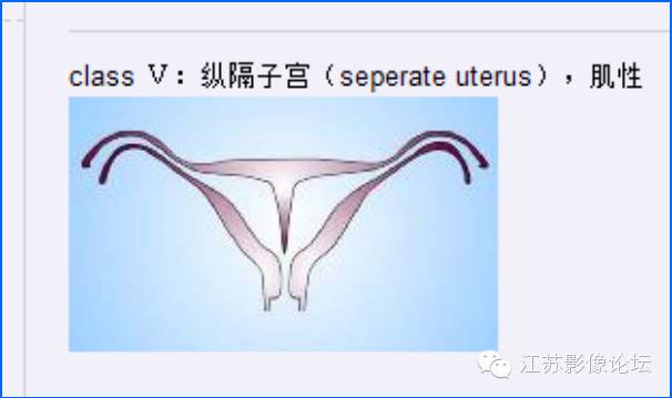 uterus_uterus_uterus