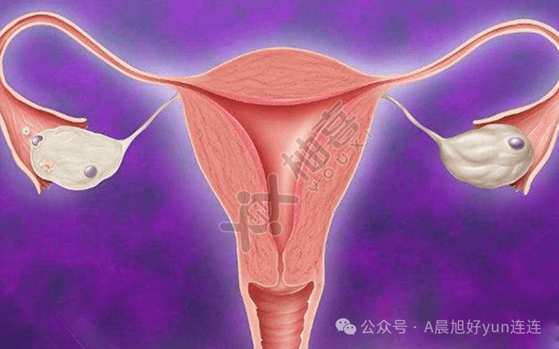 uterus_uterus_uterus