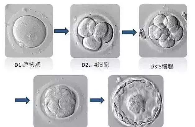 移植婴儿试管美国医生_移植婴儿试管美国有补贴吗_美国试管婴儿移植