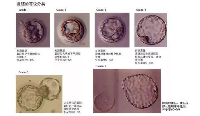 美国试管婴儿移植_移植婴儿试管美国医生_移植婴儿试管美国有补贴吗